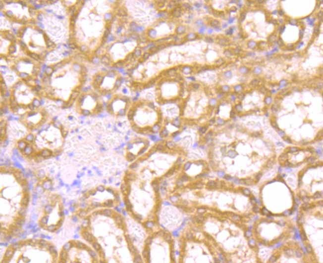 Anti-PAK2 Antibody (7G572)