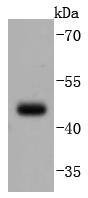 Anti-PAX5 Antibody (2B642)
