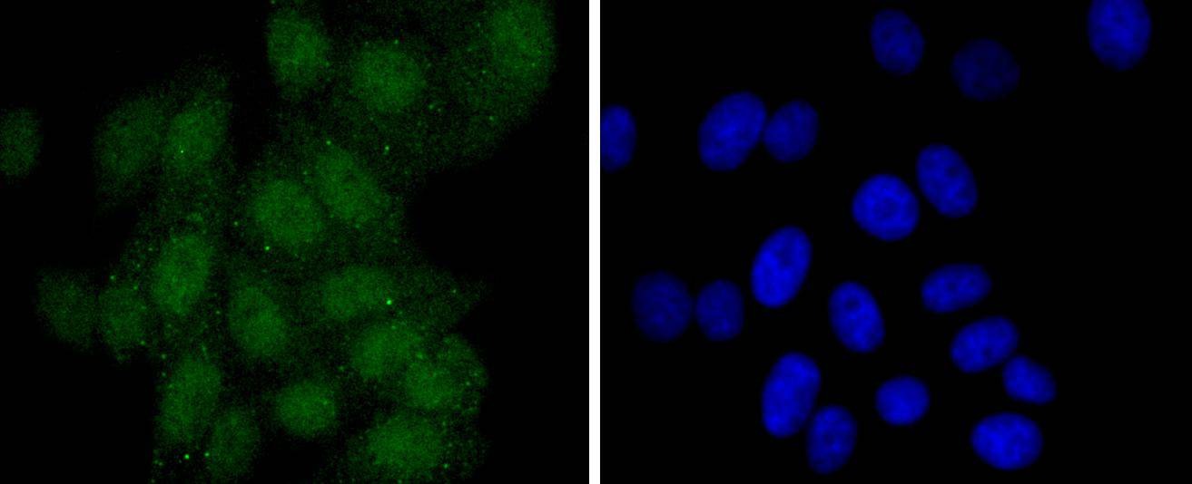 Anti-PAX5 Antibody (2B642)