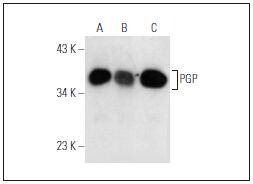 Anti-PGP Antibody (7X310)
