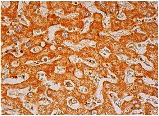 Anti-PGP Antibody (7X310)