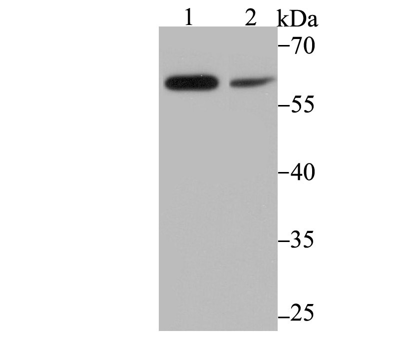 Anti-PAK2 Antibody (7G572)
