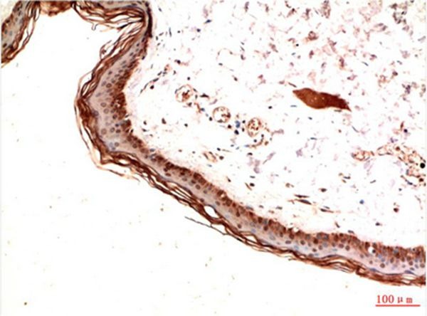 Anti-PDGF R alpha/PDGFRA Antibody (7T981)