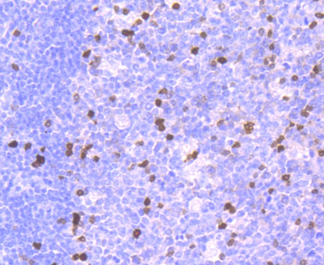 Anti-Parvalbumin/PVALB Antibody (3W969)