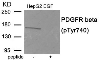 Anti-Phospho-PDGFRB (Tyr740) Polyclonal Antibody