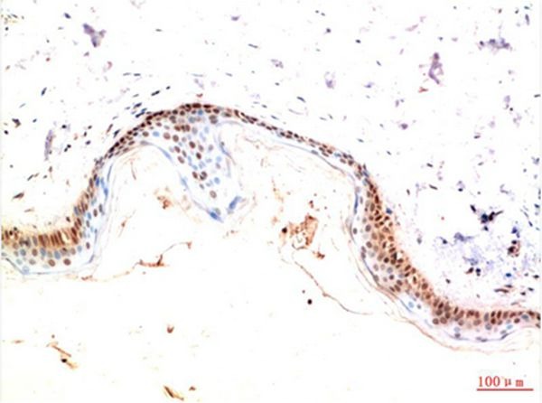 Anti-PDGF R alpha/PDGFRA Antibody (3H634)