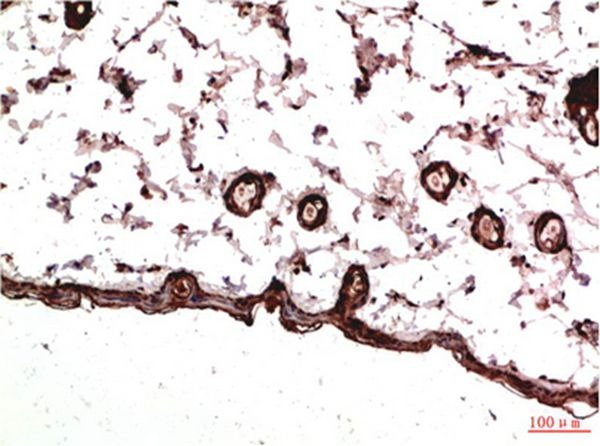 Anti-PDGF R alpha/PDGFRA Antibody (7T981)