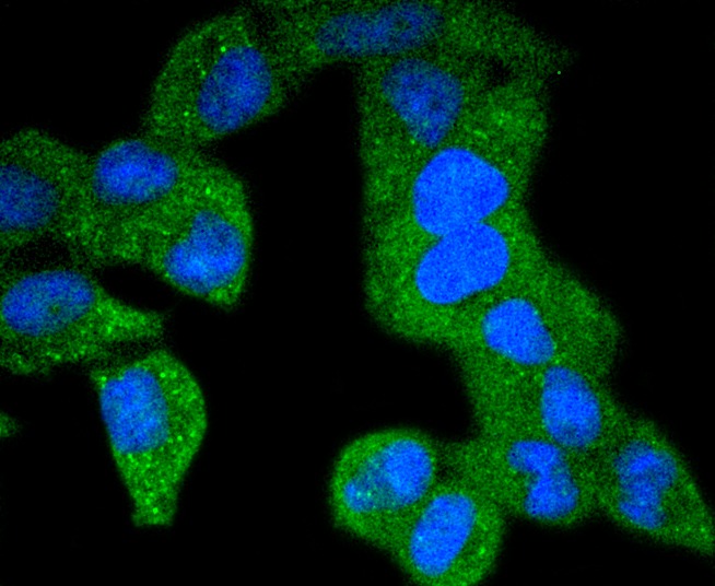 Anti-Phospho-PDGFRB (Y740) Antibody (1I961)