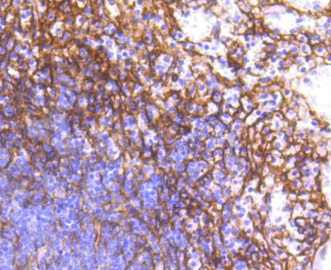Anti-PDGFRB Antibody (6N196)