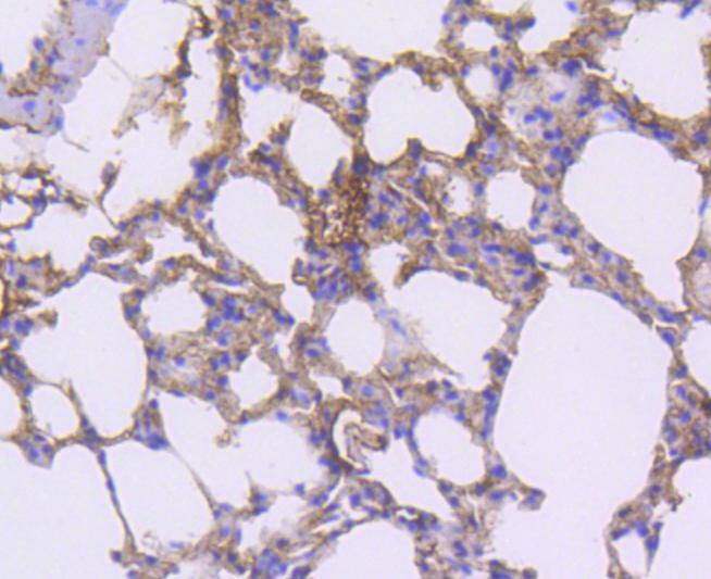 Anti-PDGFRB Antibody (6N196)