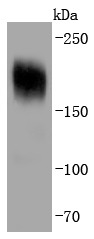 Anti-PDGF R alpha/PDGFRA Antibody (8J71)