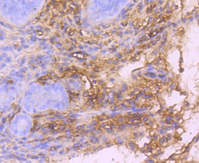 Anti-PDGF R alpha/PDGFRA Antibody (8J71)