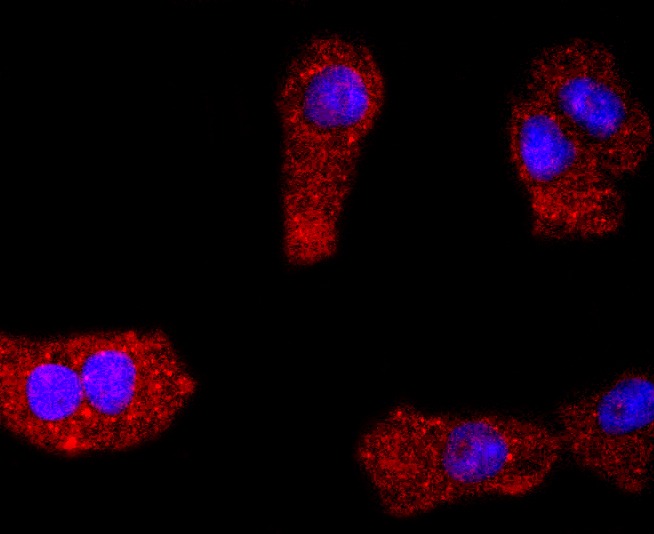 Anti-PDGF R alpha/PDGFRA Antibody (8J71)