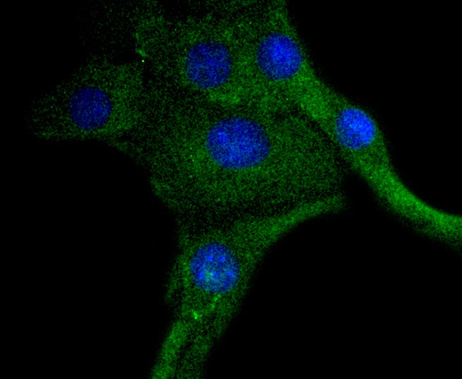 Anti-Phospho-PDGFRB (Y740) Antibody (1I961)
