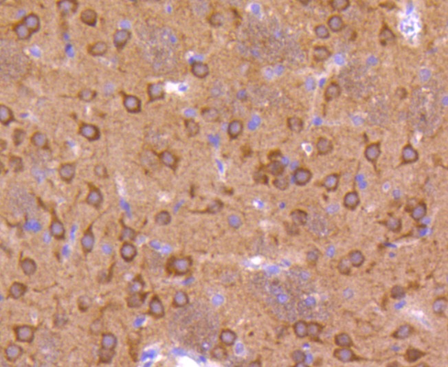 Anti-Phospho-GSK3A/B (Tyr216/279) Antibody (3N852)
