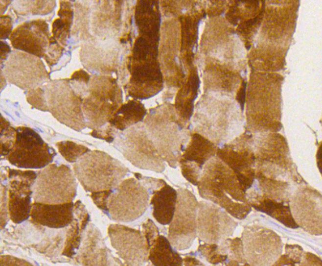 Anti-Phospho-GYS1 (Ser641) Antibody (6Y642)