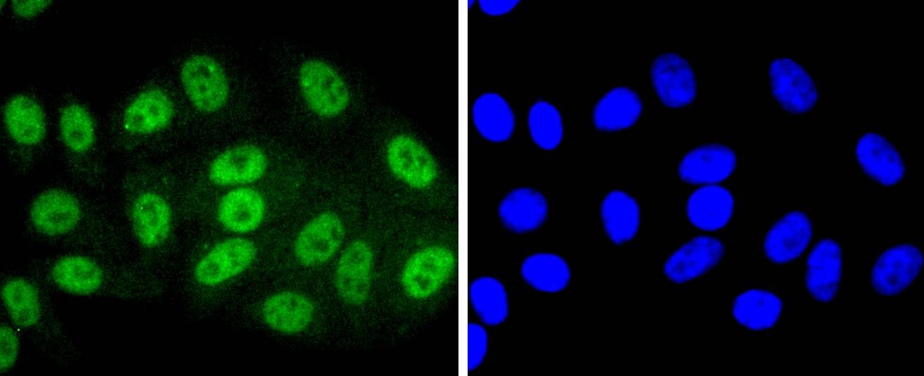 Anti-Phospho-SIRT1 (Thr530) Antibody (4S678)