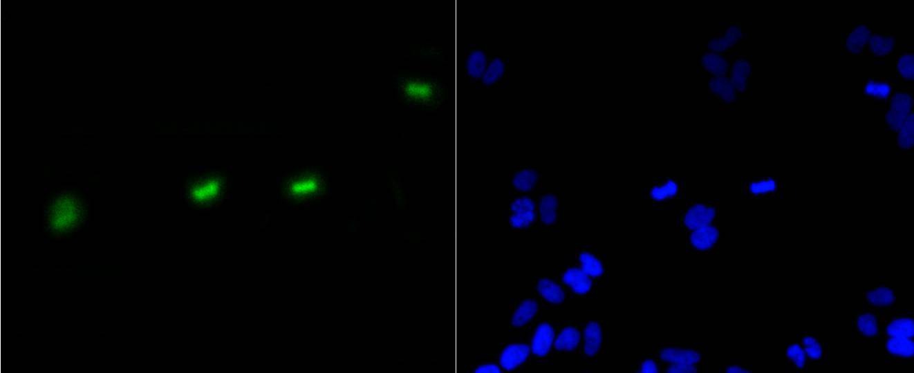 Anti-Phospho-HIST1H3A (Ser10) Antibody (5F765)