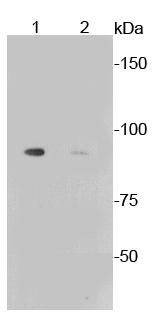 Anti-Phospho-GYS1 (Ser641) Antibody (6Y642)