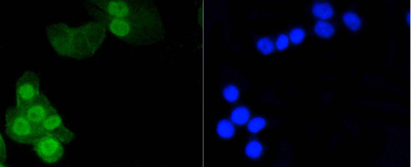 Anti-Phospho-Histone H1.3/1.4 (Thr17) Antibody (6O691)
