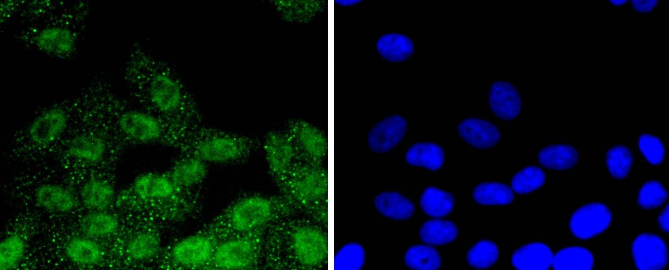 Anti-Phospho-RPS6KA1 (Thr359, Ser363) Antibody (9N204)