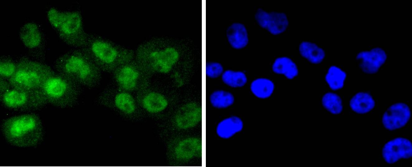 Anti-Phospho-RPS6KA1 (Thr359, Ser363) Antibody (9N204)