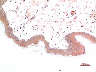 Anti-Phospho-SMAD3 (S425) Antibody (5Q618)