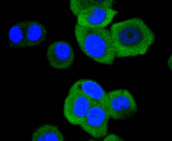 Anti-Phospho-Hsp27/HSPB (Ser78) Antibody (3C571)