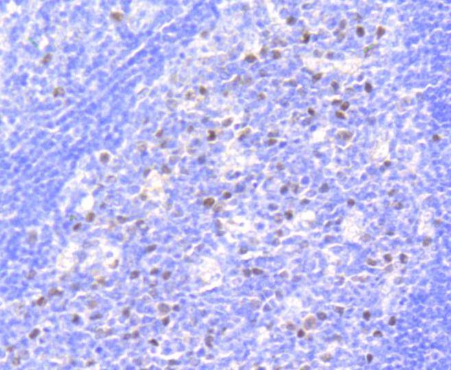 Anti-Phospho-RB1 (Ser807) Antibody (7O884)