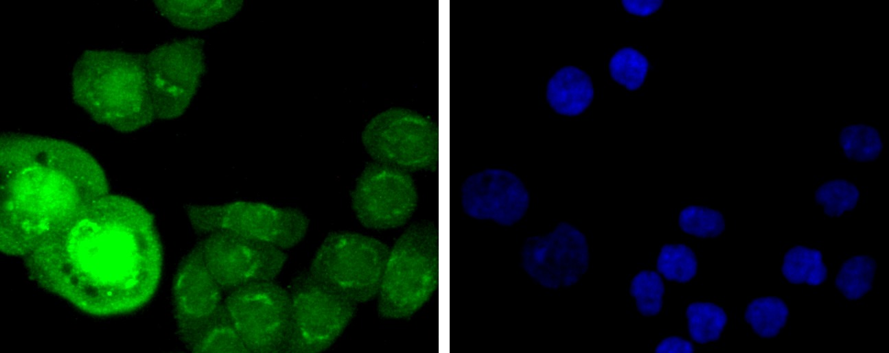 Anti-Phospho-HSF1 (Ser326) Antibody (1V417)