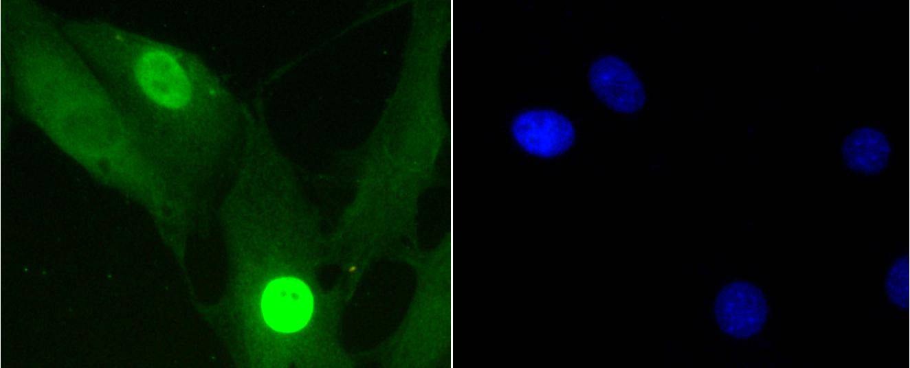 Anti-Phospho-Histone H1.3/1.4 (Thr17) Antibody (6O691)