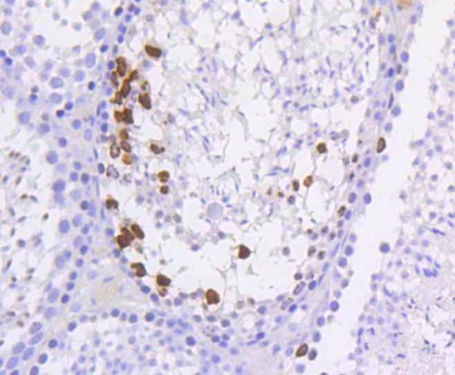 Anti-Phospho-HIST1H3A (Ser10) Antibody (5F765)