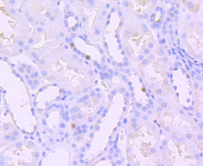 Anti-Phospho-SIRT1 (Thr530) Antibody (4S678)