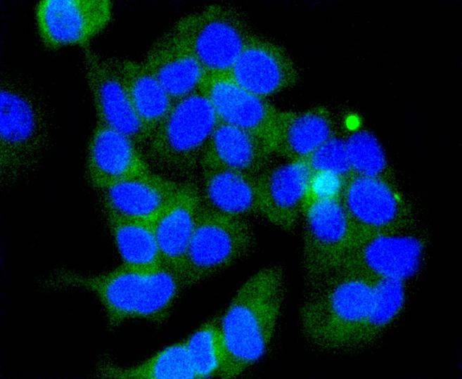 Anti-Phospho-GSK3B (Ser 9) Antibody (9V640)