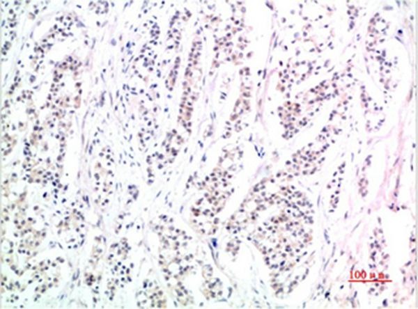 Anti-Phospho-SMAD3 (S425) Antibody (5Q618)