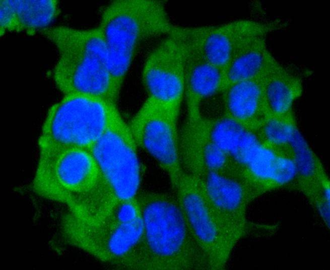 Anti-Phospho-RPS6KA1 (Ser380) Antibody (2P405)