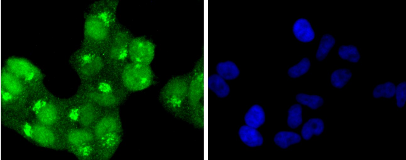 Anti-Phospho-HSF1 (Ser326) Antibody (1V417)