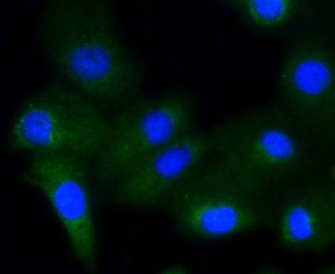 Anti-Phospho-GYS1 (Ser641) Antibody (6Y642)