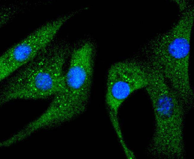 Anti-Phospho-Hsp27/HSPB (Ser78) Antibody (3C571)