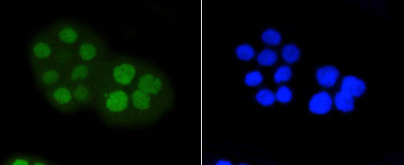 Anti-Phospho-RB1 (Ser807) Antibody (7O884)
