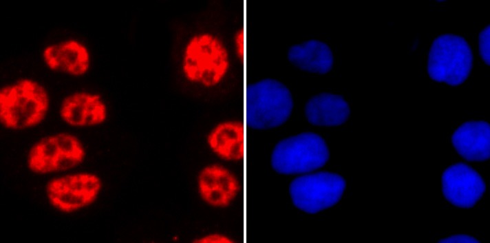 Anti-Phospho-POLR2A (Ser2) Antibody (2B504)