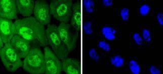 Anti-Phospho-EGFR (Tyr1068) Antibody (4G610)