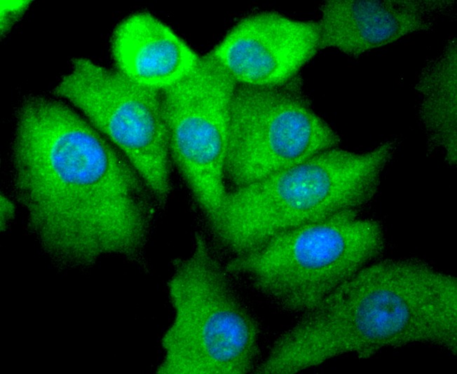 Anti-Phospho-EGFR (Ser695) Antibody (1J343)
