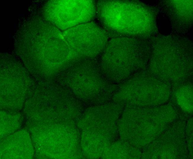 Anti-Phospho-EGFR (Y1173) Antibody (4R680)