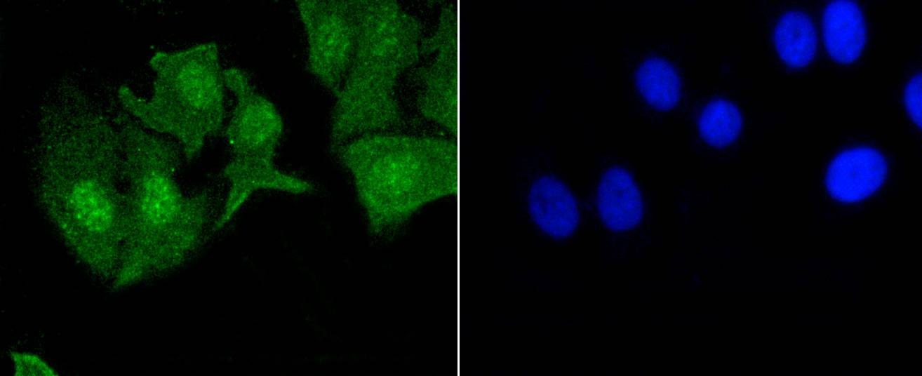 Anti-Phospho-EGFR (Tyr1092) Antibody (6T663)