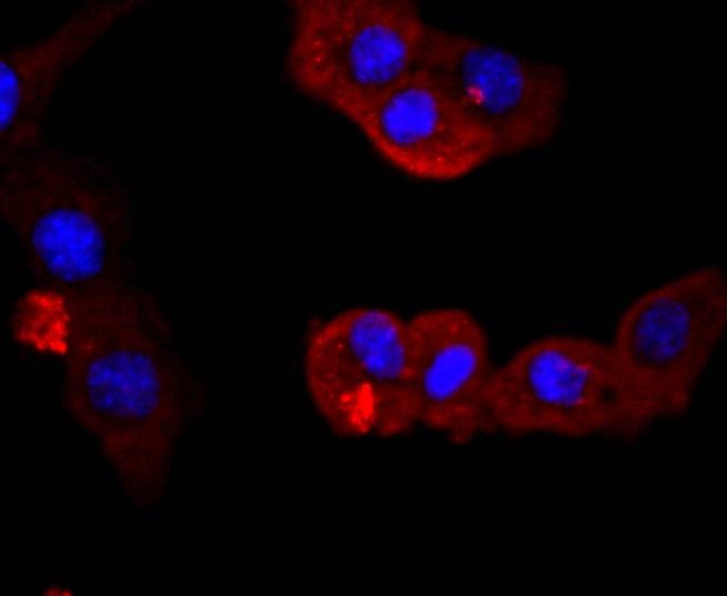 Anti-PIK3R1 Antibody (9O121)