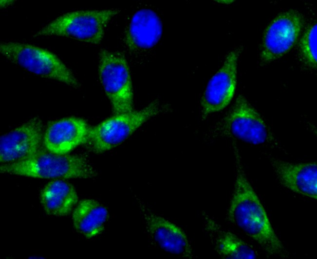 Anti-PKA 2 beta Antibody (8T490)
