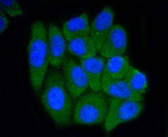 Anti-PRMT5 Antibody (3P436)