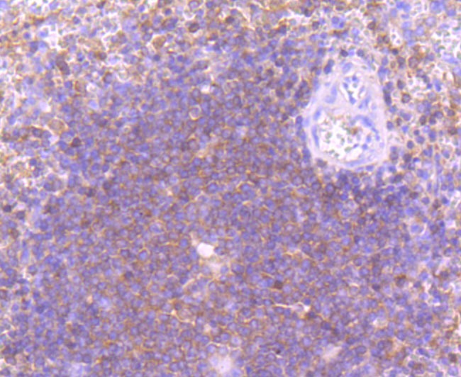 Anti-PI 3 Kinase p110 delta Antibody (6K824)