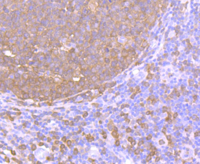 Anti-PRKCD Antibody (8E672)